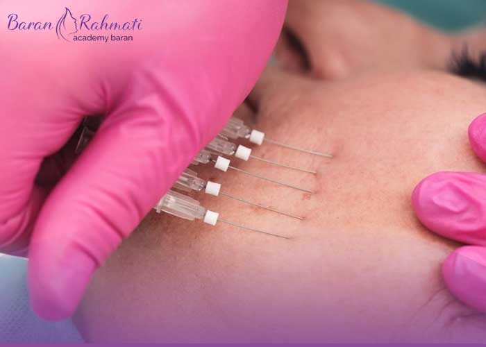 Read more about the article آموزش کاشت نخ لیفت در اراک