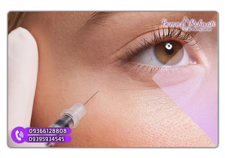 تزریق فیلر برای جوانسازی پوست در منزل