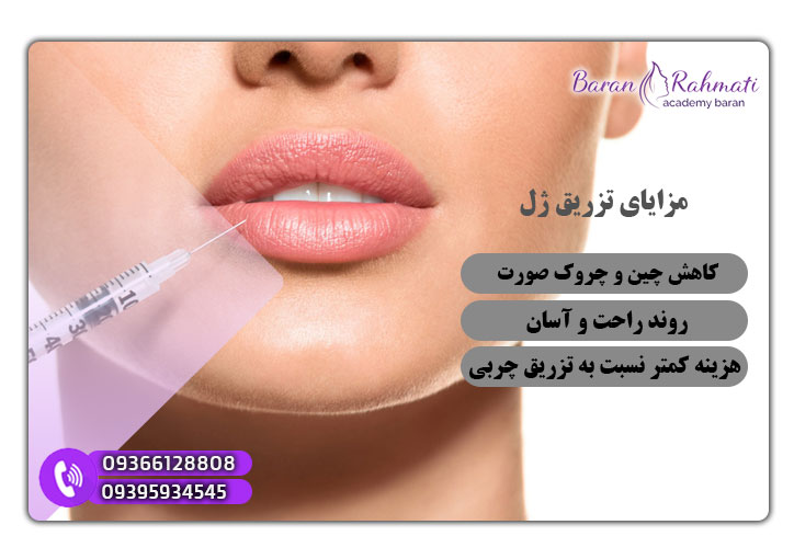 مزایای تزریق ژل