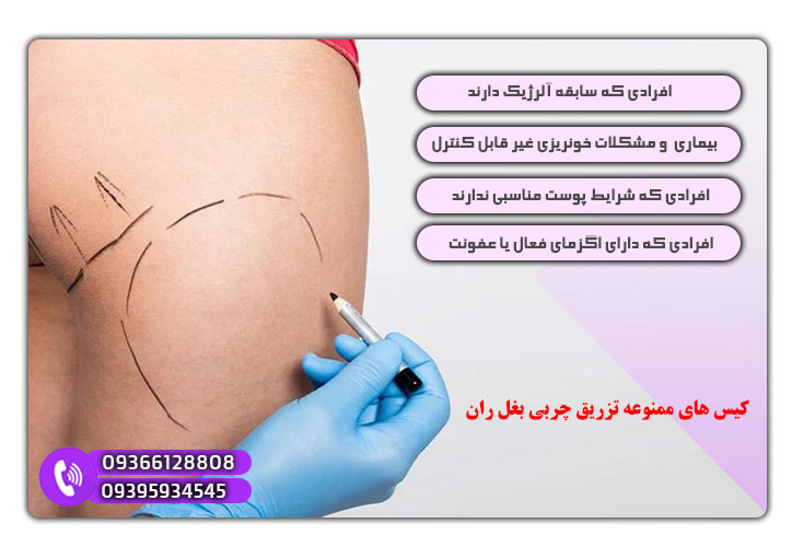 چه کسانی نمیتوانند تزریق چربی بغل ران انجام دهند