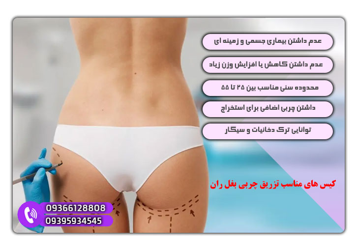 کیس های مناسب تزریق چربی بغل ران