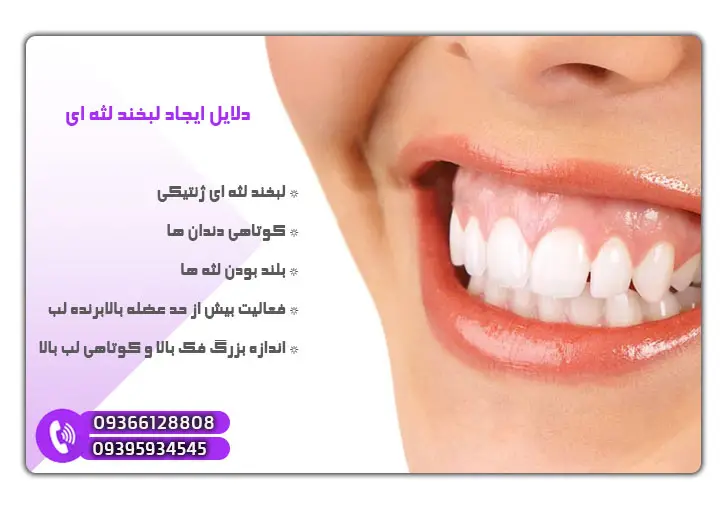 دلایل ایجاد لبخند لثه ای