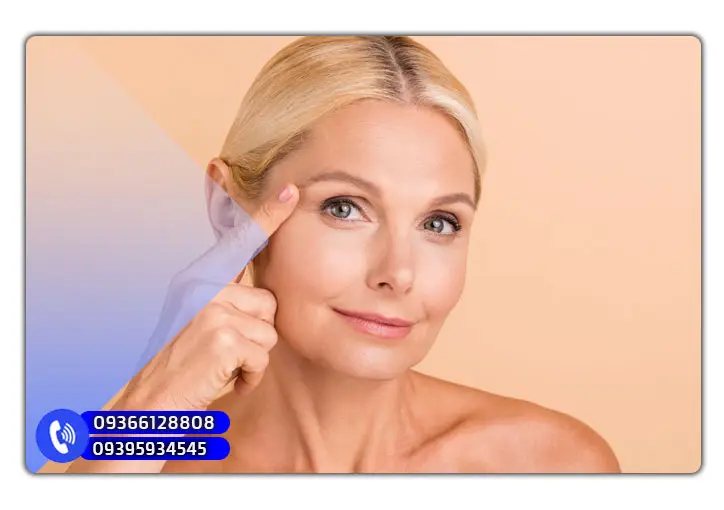 آموزش لیفت شقیقه تخصصی در یزد