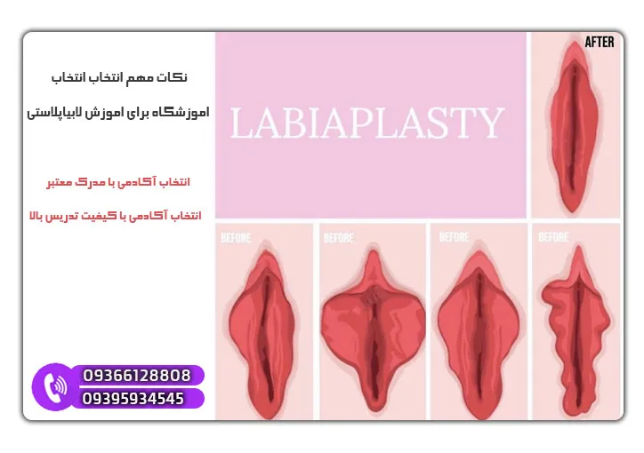بهترین دوره لابیاپلاستی در جنوب کشور 