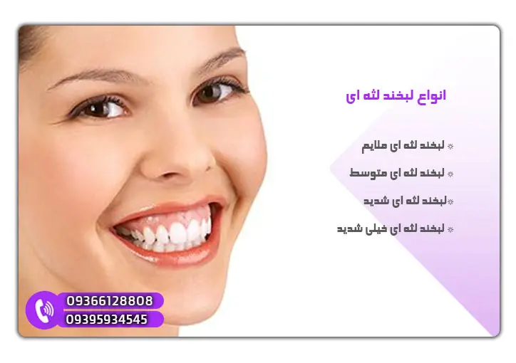 انواع لبخند لثه ای