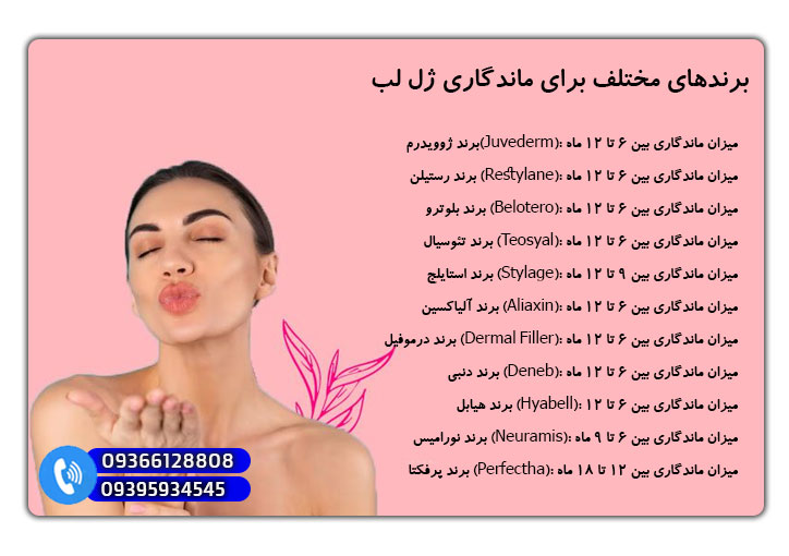 برندهای مختلف برای ماندگاری ژل لب