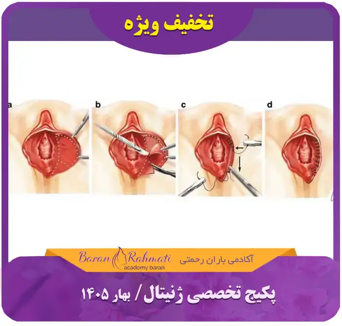 Read more about the article دوره آموزشی زیبایی ژنیتال (زیبایی زنان)