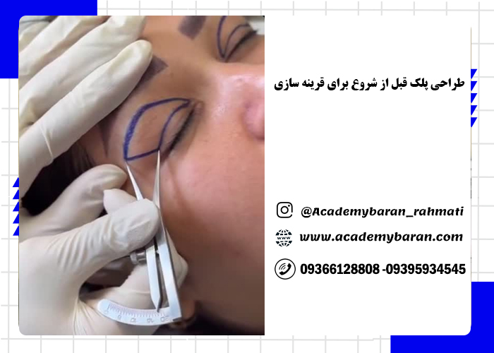 بلفاروپلاستی پلک