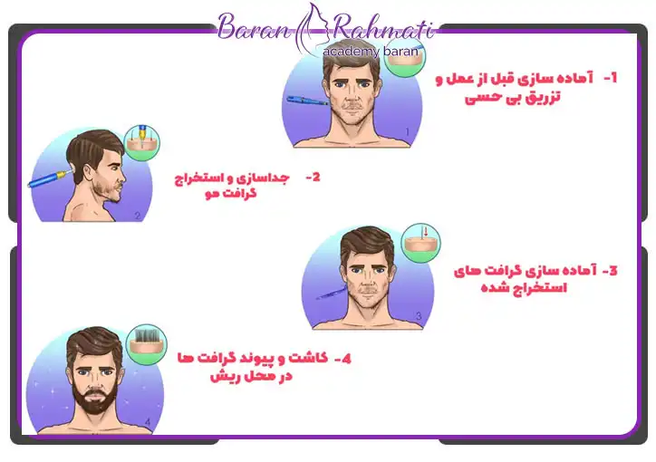 کاشت ریش باران رحمتی