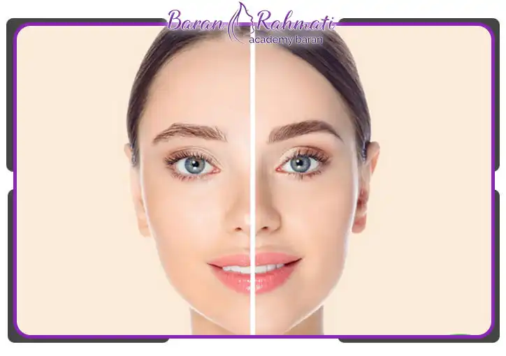 آکادمی کاشت ابرو