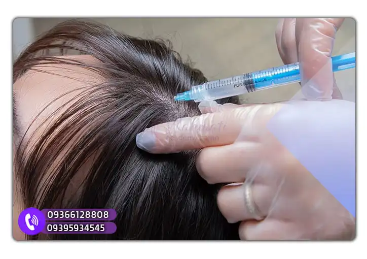 آموزش مزوتراپی در اصفهان