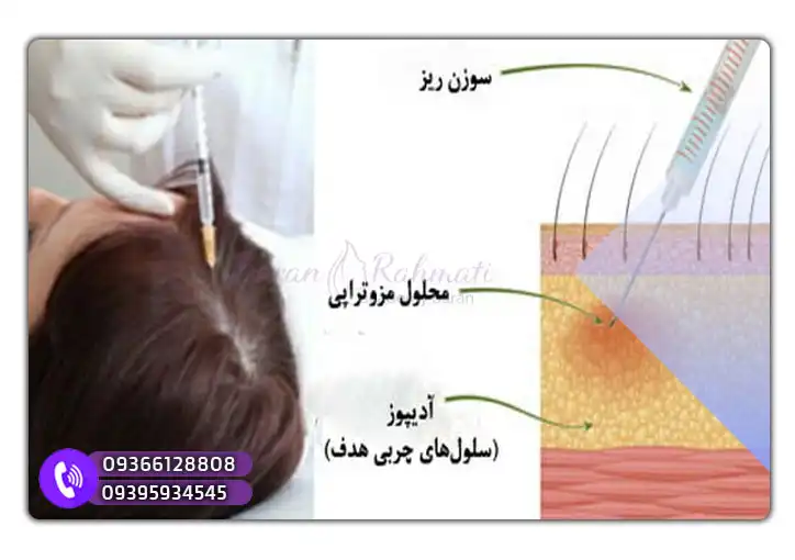 آموزش مزوتراپی شیراز باران رحمتی
