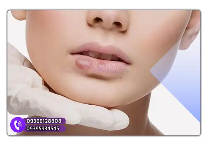 علت بروز حساسیت به ژل لب