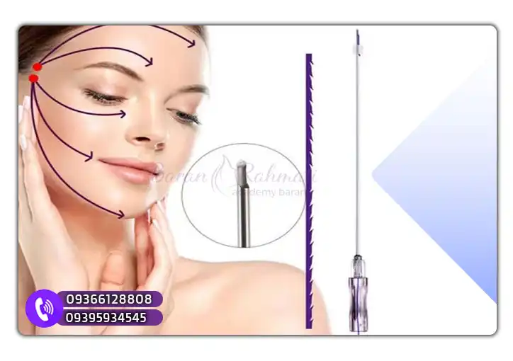 هزینه لیفت صورت با نخ کاگ