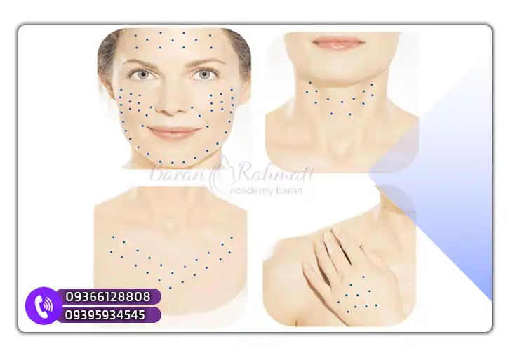 آموزش مزوژل در شیراز آکادمی باران رحمتی