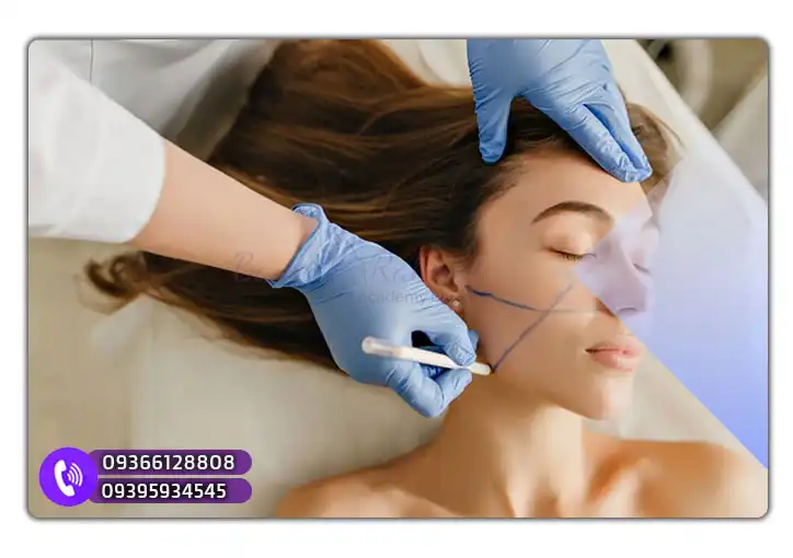 بازارکار و درامد لیفت با نخ در مشهد