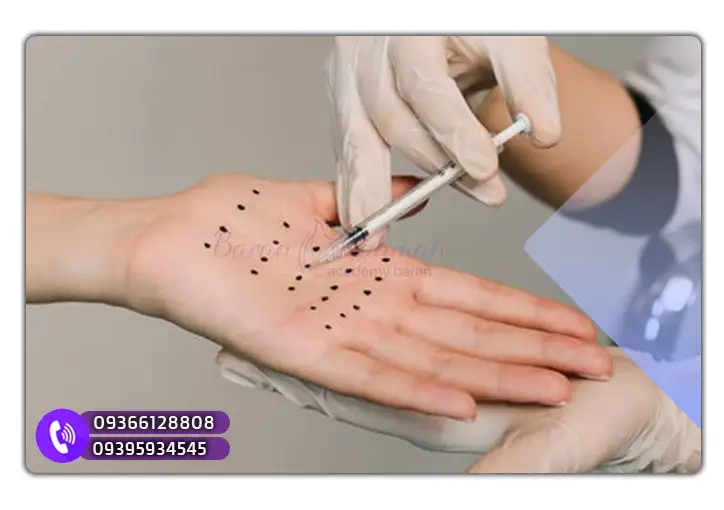 مدرک تزریق بوتاکس کف دست