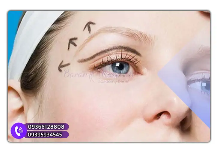 مزایای لیفت ابرو با بوتاکس