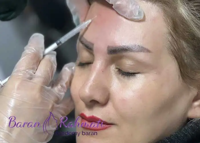 Read more about the article آموزش تزریق ژل و بوتاکس در سراسر کشور با ✅ آکادمی باران رحمتی