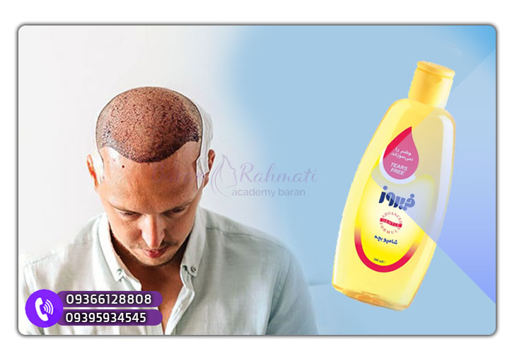 شامپو بچه برای بعد کاشت مو