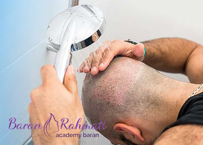 Read more about the article نکات مهم برای شستشوی سر بعد از کاشت مو