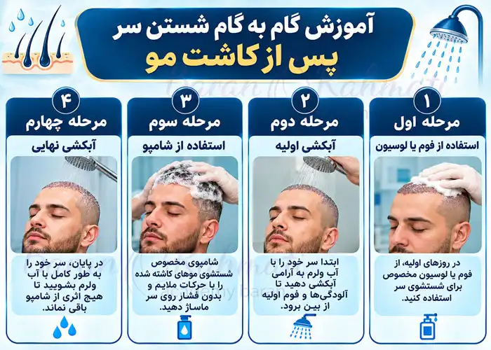 آموزش گام به گام شستن سر پس از کاشت مو
