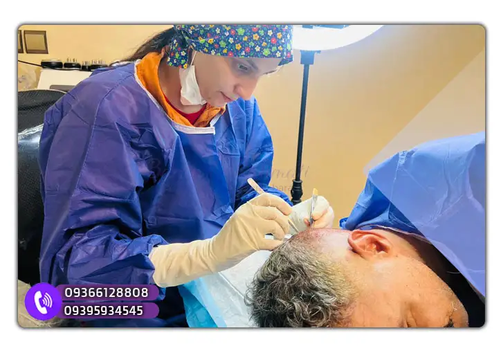 افراد مجاز به شرکت در آموزش کاشت مو در قشم