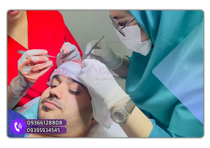 بازار کار و درآمد تکنسین کاشت مو بوشهر