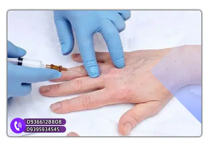 چند جلسه بوتاکس دست لازم است