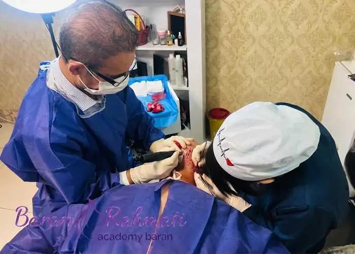 Read more about the article آموزش کاشت مو و ابرو در سمنان + جزوه و فیلم آموزشی