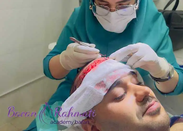 آموزش کاشت مو و ابرو در کردستان