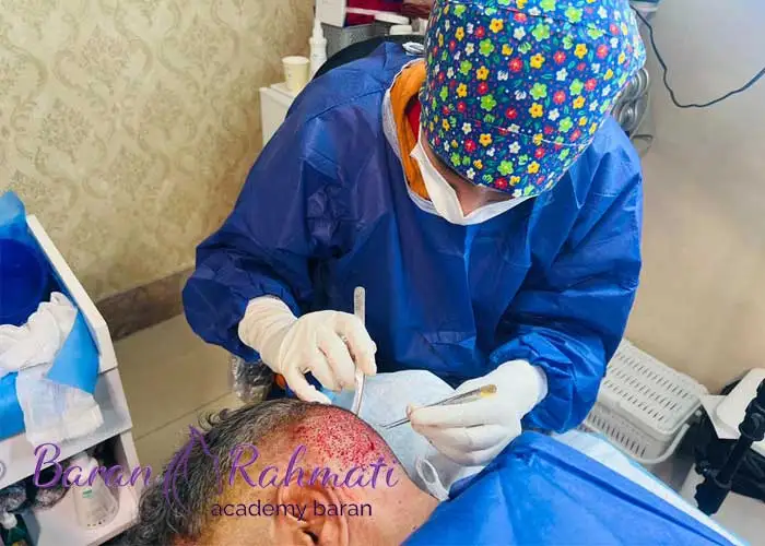 Read more about the article آموزش کاشت مو در قزوین + مدرک معتبر