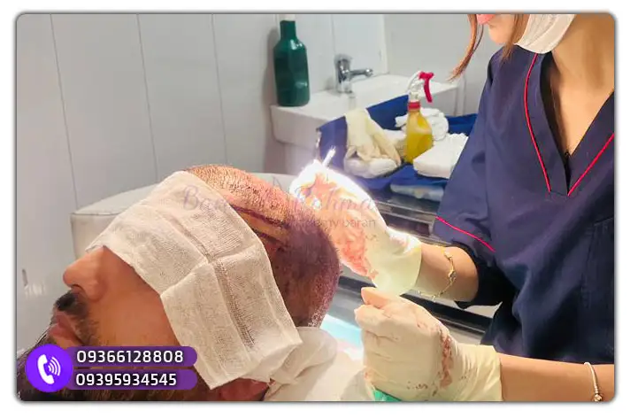 هزینه شرکت در آموزش کاشت مو قزوین