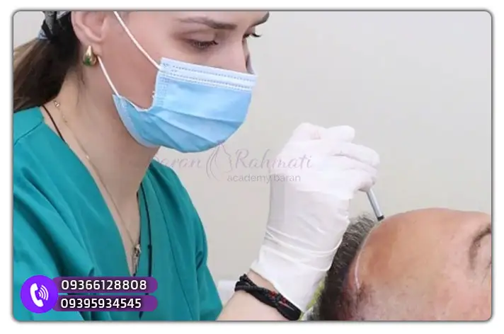 آموزش عملی کاشت مو سمنان