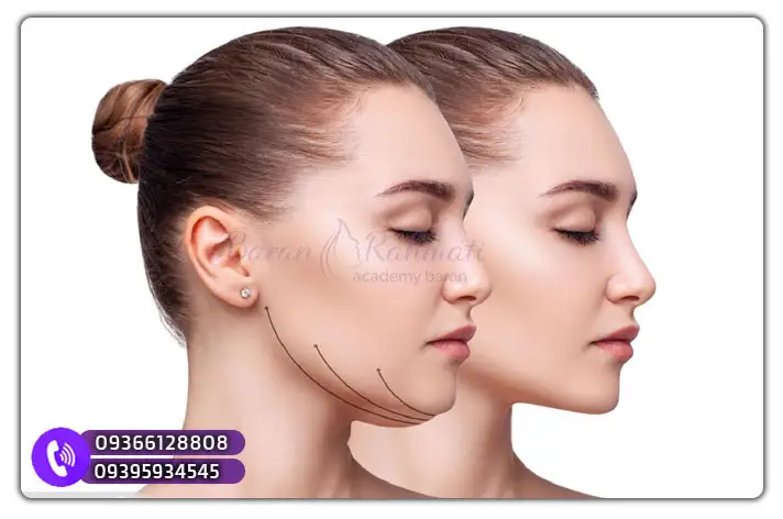مرکز آموزش حرفه‌ای لیپوساکشن غبغب در اراک