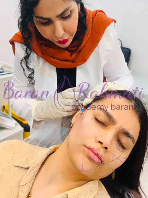 gel-injection-and-botox-training-in-tehranga1